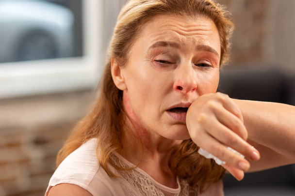 Woman having running nose and cough suffering from allergy - Zdjęcie, obraz
