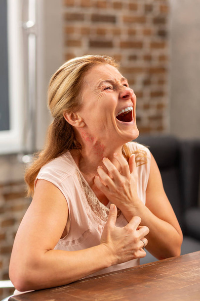 Kypsä sairas nainen huutaa kivun ja ihottuman vuoksi
 - Valokuva, kuva