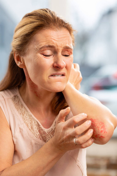 Blond włosach kobiety uczucie ból skóry, cierpiących na alergię - Zdjęcie, obraz