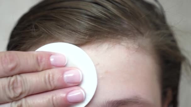 Las adolescentes aplican una crema hidratante para la cara para el acné. chica se frota la frente con una servilleta. Procedimientos cosméticos para adolescentes. primer plano
 - Metraje, vídeo