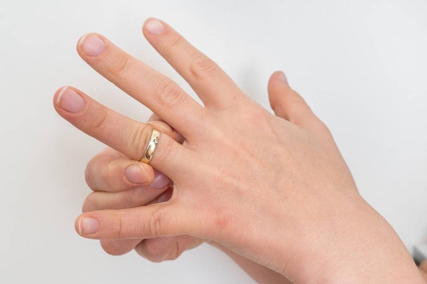 女性が詰まった結婚指輪を取ることができません。 - 写真・画像