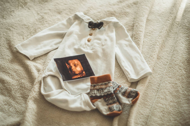 Μικρά χειροποίητα ρούχα του μωρού. Φωτογραφία από το υπερηχογράφημα. νεογέννητα ρούχα σε μπεζ μάλλινη φόντο - Φωτογραφία, εικόνα