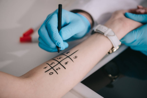 weergave van doctor in de latex handschoenen houden marker pen in de buurt van gemarkeerde vrouwelijke hand bijgesneden   - Foto, afbeelding
