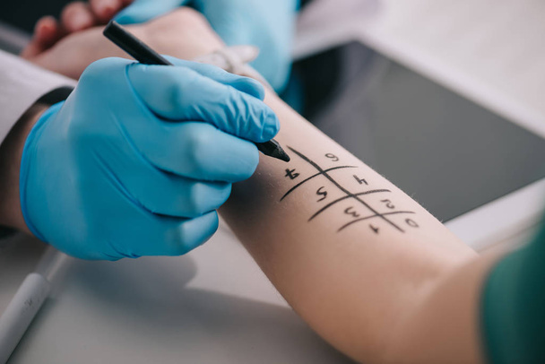 oříznutý pohled lékaře v latexové rukavice podržením pera značky poblíž ženské ruky   - Fotografie, Obrázek