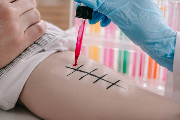 περικοπεί άποψη του γιατρού στην εκμετάλλευση σιφωνίου με το κόκκινο υγρό κοντά αρσενική χέρι ενώ κάνει αλλεργία δοκιμή στο εργαστήριο  - Φωτογραφία, εικόνα