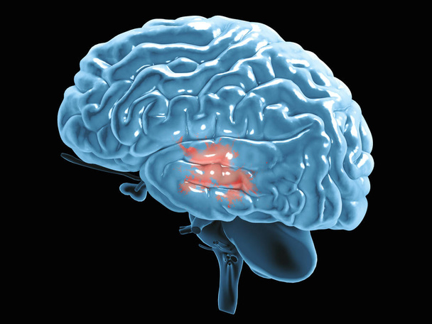 Część mózgu widoczne w profilu, części mózgu. Choroby zwyrodnieniowe, Parkinsona, synapsy, neurony, Alzheimera, renderowania 3d - Zdjęcie, obraz
