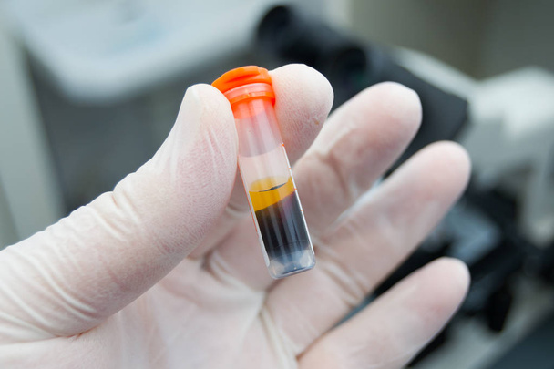 Wissenschaftler hält eine zentrifugierte Blutprobe in der Hand  - Foto, Bild