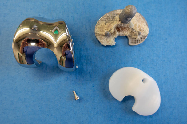 implantes extraídos de una prótesis de rodilla
 - Foto, Imagen