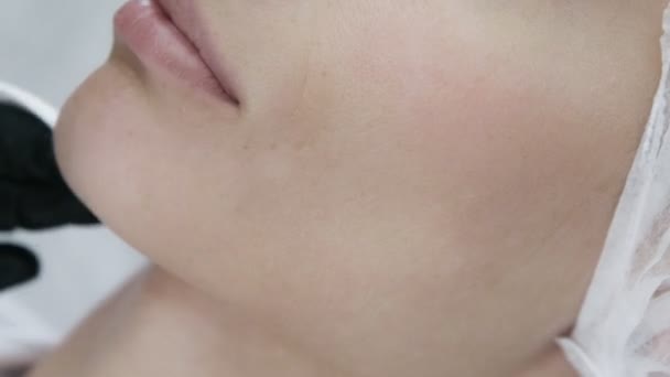 Primer plano parte de la cara femenina durante el procedimiento cosmético. El médico desinfecta y limpia la piel de los pacientes con un disco de algodón antes de las inyecciones
 - Imágenes, Vídeo