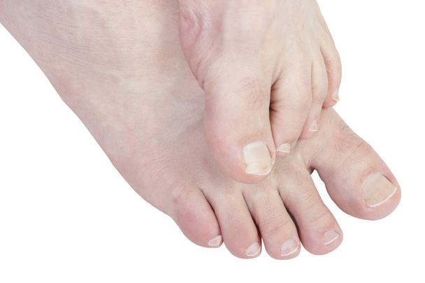 Itchy feet. - Photo, Image