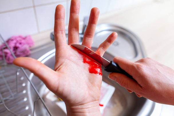 Una mujer se corta con un cuchillo en la cocina
 - Foto, imagen