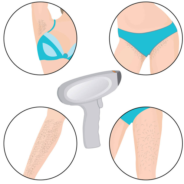 Hair removal zones laser removal vector illustration - Vector, Image