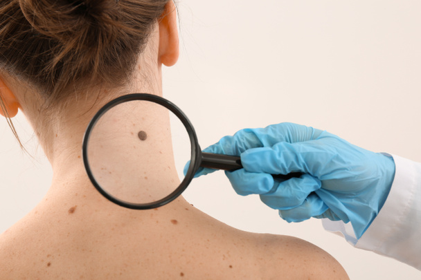 Dermatoloog mol patiënt op lichte achtergrond onderzoek - Foto, afbeelding