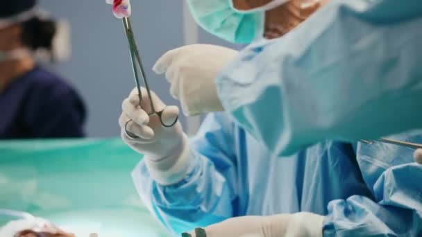 Umtriebige Chirurgen reichen einander während einer Operation eine Schere  - Filmmaterial, Video