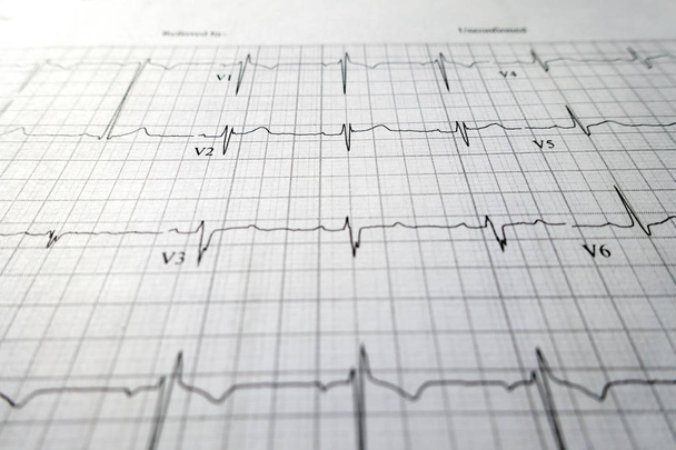 bliska EKG badanie rytmu serca - Zdjęcie, obraz