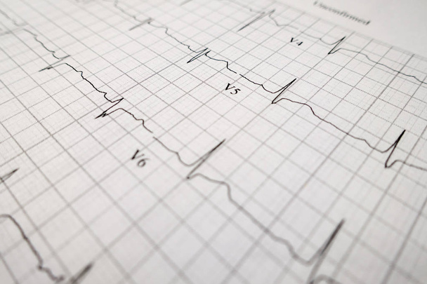 slective középpontjában a szív teszt EKG - Fotó, kép