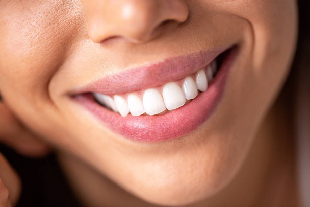 Close up of a beautiful smile with shining white teeth - Zdjęcie, obraz
