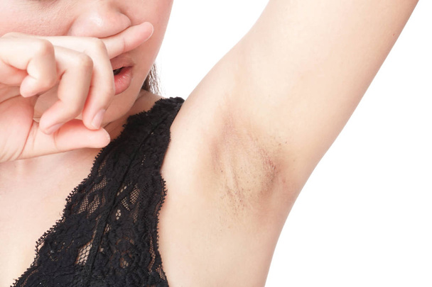 女性問題黒armpit上の白い背景のためのスキンケアと美しさの概念 - 写真・画像