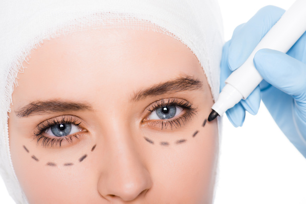 cropped view of plastic surgeon in latex glove holding marker pen near girl with marks on face isolated on white  - Photo, Image