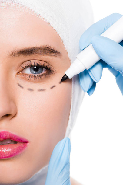 vista cortada de cirurgião plástico em luva de látex azul segurando caneta marcador perto da mulher com marcas no rosto isolado no branco
  - Foto, Imagem