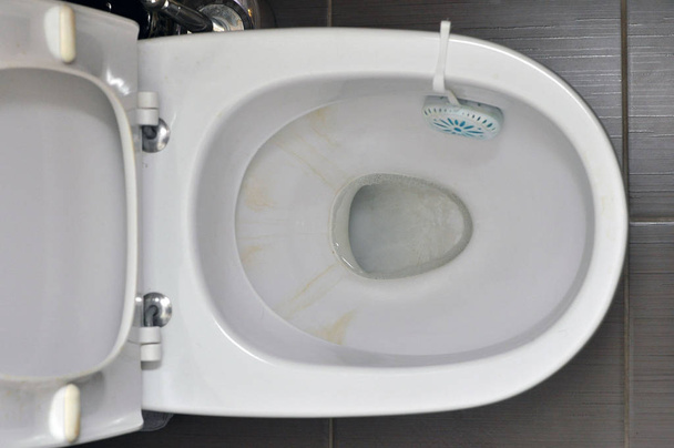 WC w domu z żółtymi plamami z wody, jednostka czyszcząca z detergentem na obręczy. - Zdjęcie, obraz