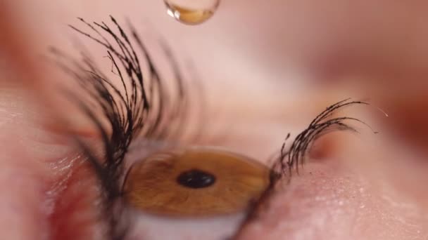 Αργή κίνηση close up: καστανά μάτια και αναβοσβήνει μετά από μεγάλη σταγόνα ματιών κάνει επαφή με ερεθισμένο κερατοειδή. Λεπτομερής πλευρική όψη της γυναίκας εφαρμόζοντας οφθαλμικές σταγόνες για να απαλύνει το ξεραμένο μάτι. Το κεχριμπάρι ματιών αναβοσβήνει. - Πλάνα, βίντεο