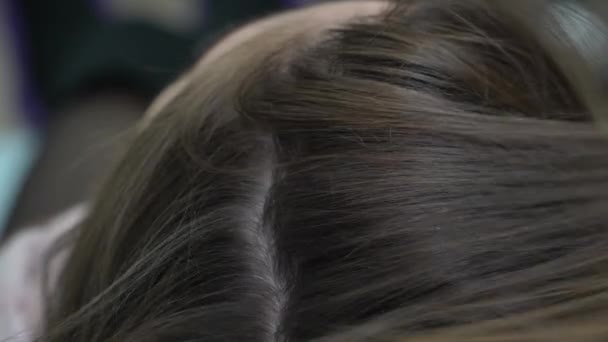 Docteur esthéticienne fait une injection de seringue pour les cheveux dans le haut de la tête de la fille
 - Séquence, vidéo