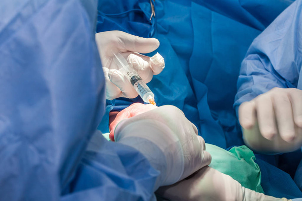 Médicos que realizam uma cirurgia de mão
 - Foto, Imagem