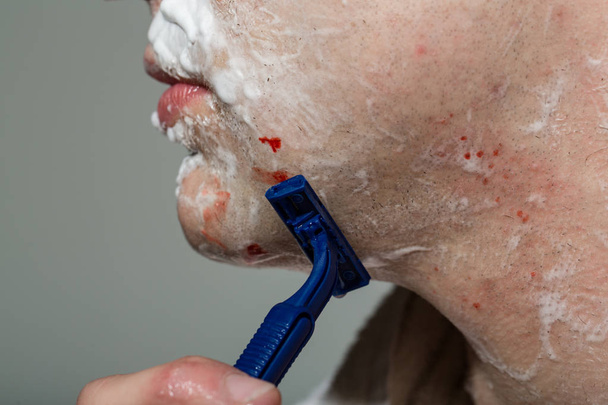 Człowiek golenie, Razor Burn z krwią. Człowiek golenia za pomocą brzytwa z pianki śmietankowej. Facet usuwa włosy brody twarzy. Pielęgnacja i higiena skóry. Człowiek został ranny przez maszynkę - Zdjęcie, obraz