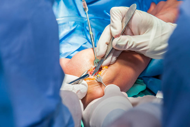 Gruppo di chirurghi ortopedici che eseguono un intervento chirurgico su un braccio paziente
 - Foto, immagini