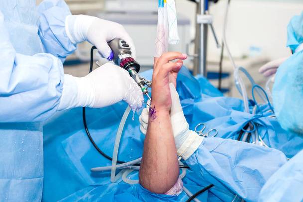 Gruppo di chirurghi ortopedici che eseguono un'artroscopia del polso su un paziente di sesso maschile
 - Foto, immagini