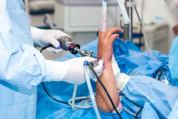 Groupe de chirurgiens orthopédistes pratiquant une arthroscopie du poignet sur un patient de sexe masculin
 - Photo, image