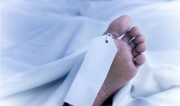 Ноги мертвого тела, опознавательный знак, крупным планом в белом листе
 - Фото, изображение