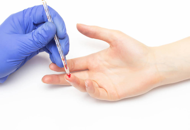The doctor takes a general clinical blood test from the patient with a finger on the determination of the blood composition for immunity and cholesterol, close-up - Φωτογραφία, εικόνα