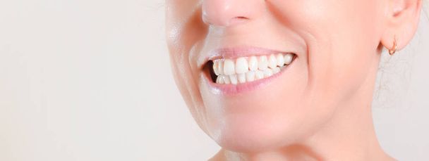 Mature woman showing perfect natural white teeth on the side - Φωτογραφία, εικόνα