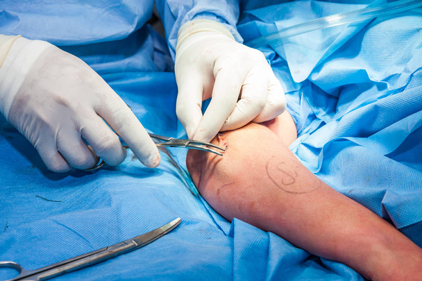 Chirurgien suturant le bras d'un patient à la fin de la chirurgie
 - Photo, image