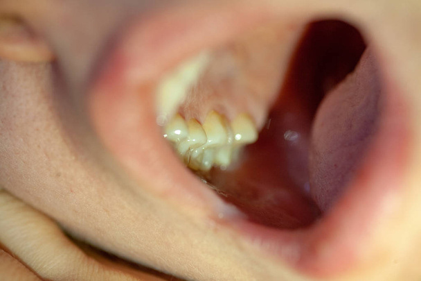Η έννοια της οδοντιατρικής θεραπείας σε οδοντιατρική κλινική - Φωτογραφία, εικόνα