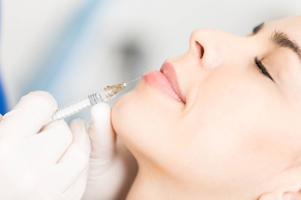 Close-up van vulstoffen worden geduwd in dermale laag van vrouw lip om vorm te verbeteren bij Skincare Clinic - Foto, afbeelding