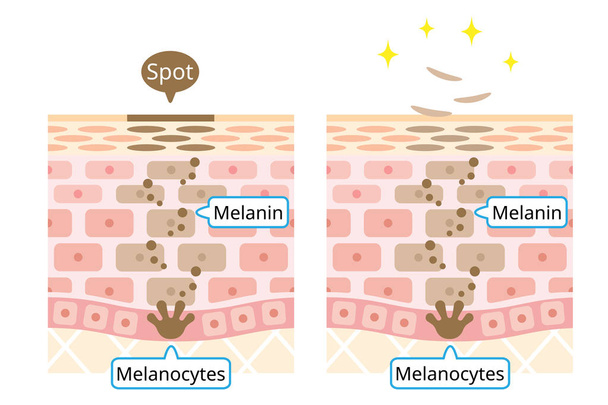 mecanismo de ilustração do turnover das células da pele. Melanina e melanócitos na camada de pele humana. conceito de beleza e cuidados com a pele
 - Vetor, Imagem