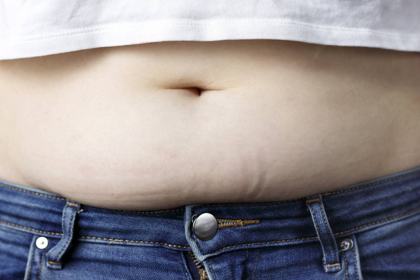 El exceso de grasa en el abdomen de cerca, el concepto de pérdida de peso
 - Foto, imagen