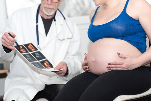 Médico mostrando imagen de ultrasonido de bebé a mujer embarazada
 - Foto, imagen