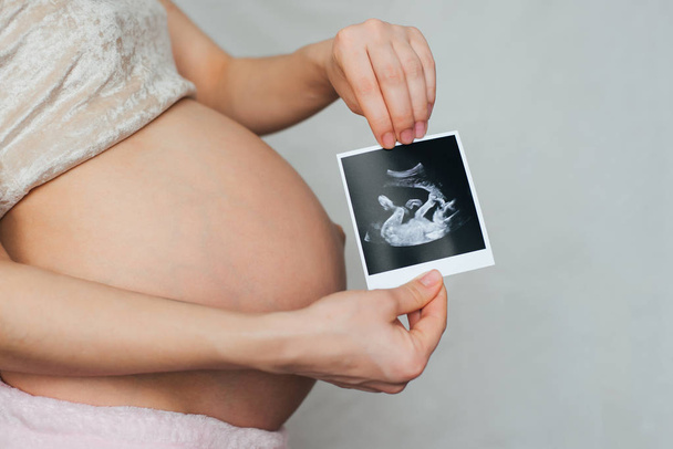kuva raskaana olevasta ultraäänestä raskaana olevan tytön käsissä
 - Valokuva, kuva