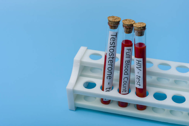 Test Testosterone Full Blood test and HIV Test in Vitro. - Fotoğraf, Görsel