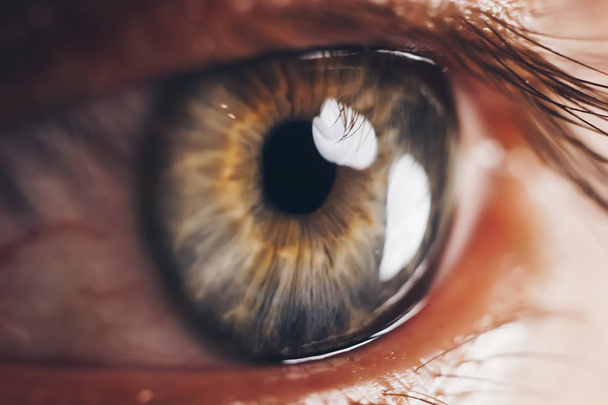macro ogen met barstende rode bloedvaten. oogbol bedekt met bloed close-up. visie problemen. - Foto, afbeelding