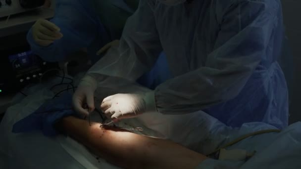 Close-up surgeon hands makes varicose vein surgery with special instruments on patient leg - Кадри, відео