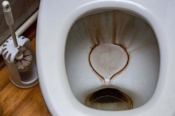 dirty toilet and brush - 写真・画像