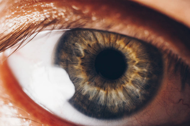 macro ogen met barstende rode bloedvaten. oogbol bedekt met bloed close-up. visie problemen. wijd open oog. - Foto, afbeelding