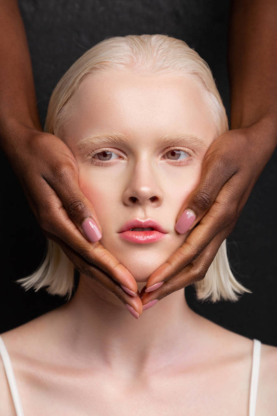 Woman with short bob cut having dark-skinned hands on face - Фото, изображение