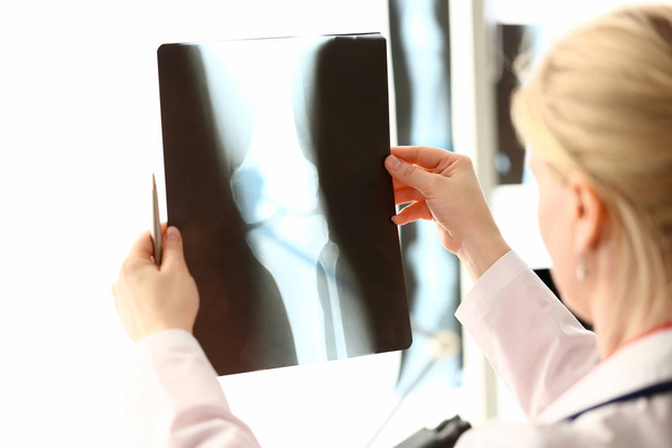 Naisradiologi pitelee kädessään röntgenkuvaa
 - Valokuva, kuva
