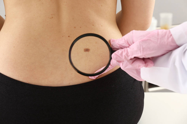 Dermatologe untersucht Muttermale von Patientin in Klinik - Foto, Bild